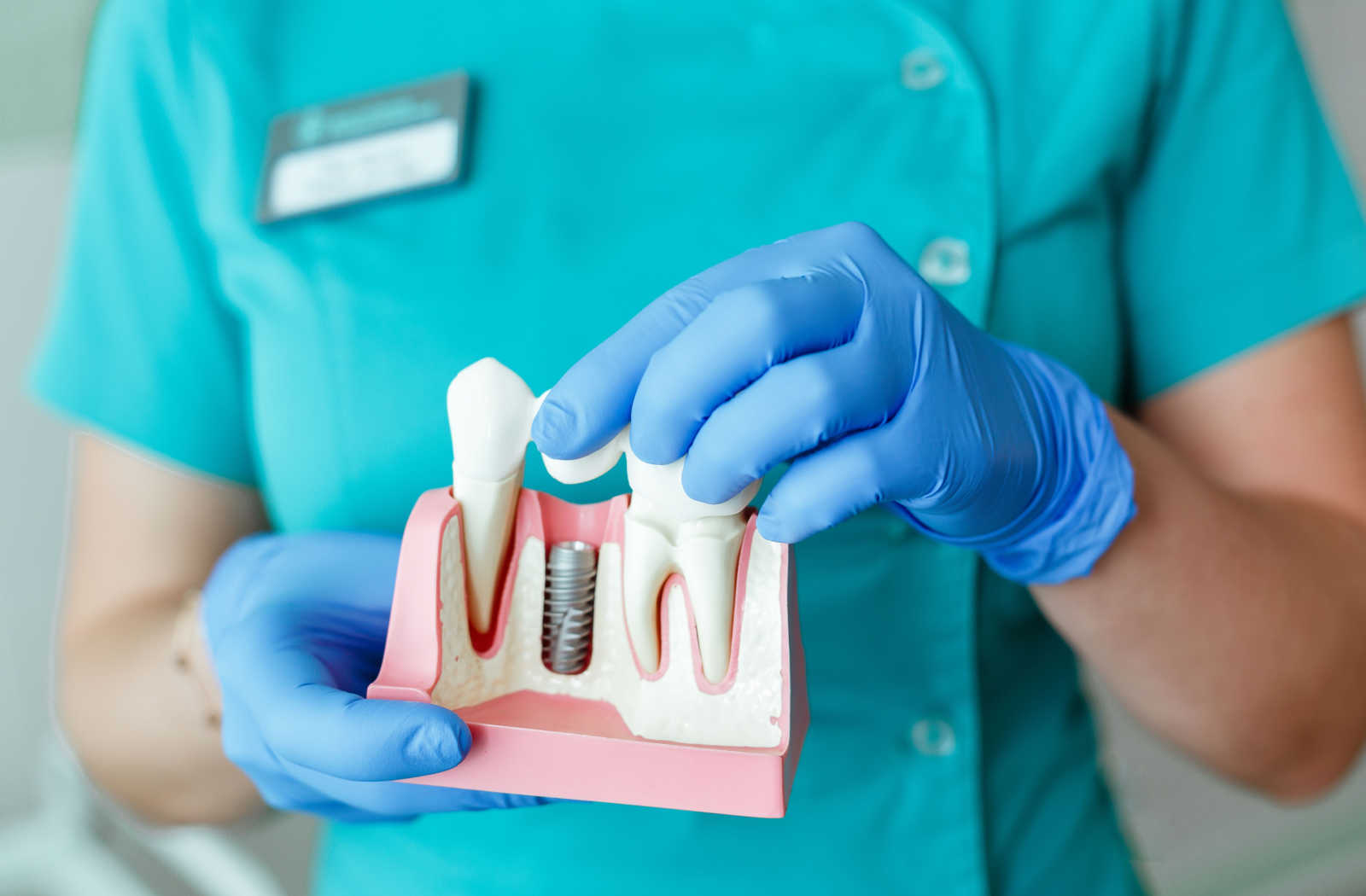 The close-up hands of a  dentist is holding a model of the tooth with a dental implant.